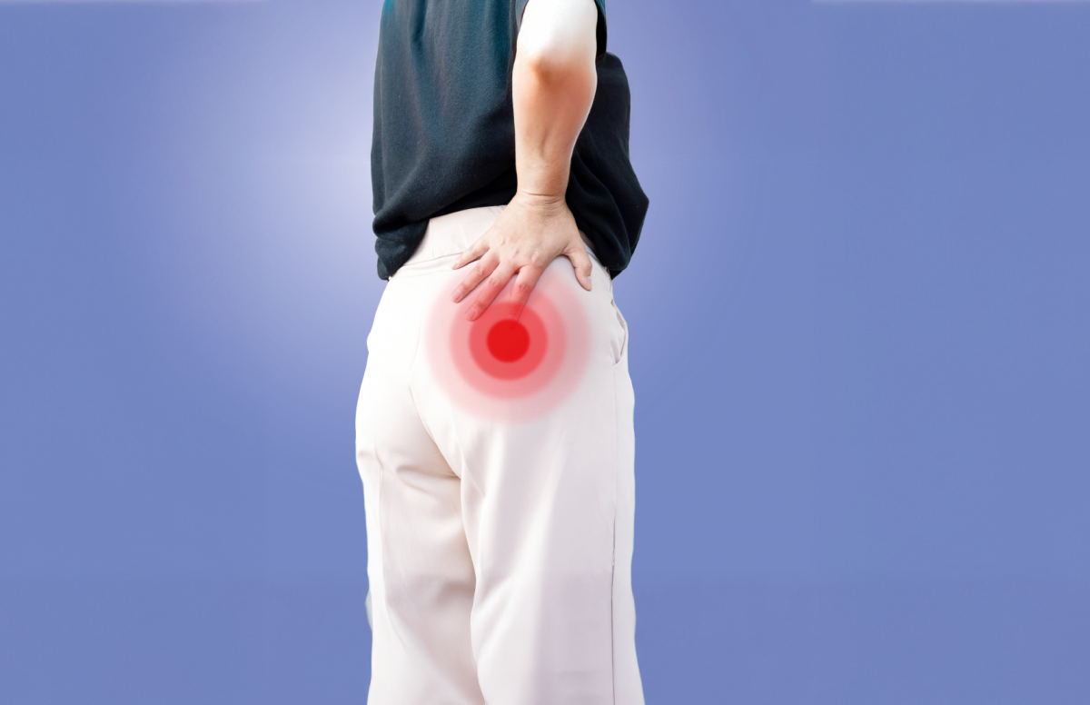 Was ist eigentlich das Piriformis-Syndrom?